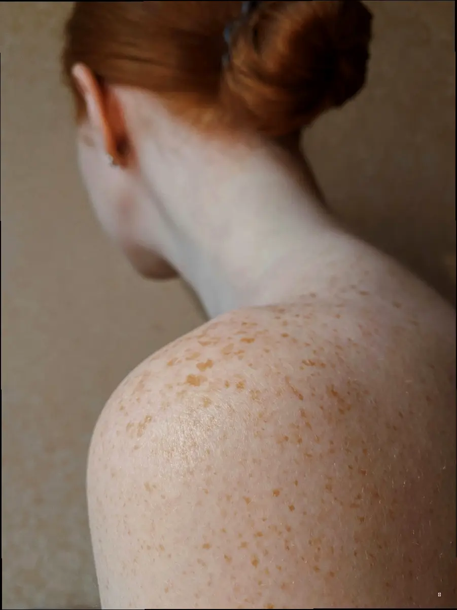 희망을 찾아서! 화농성 한선염 치료, 어떻게 해야 할까요?